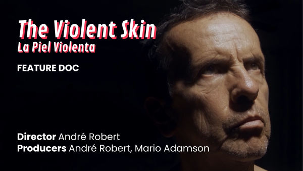 18. The violent skin